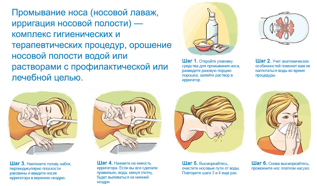 Чем промыть нос при простуде в домашних условиях Чем промыть нос при простуде в домашних условиях