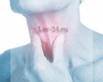 Рак горла — первые симптомы, фото на ранних стадиях, диагностика, лечение и прогноз