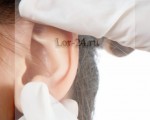 Деформация ушных раковин: причины, симптомы, лечение