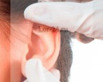 Гипертрихоз ушной раковины: признаки наследования заболевания