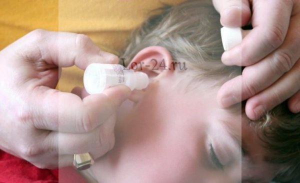 Болит ухо снаружи при нажатии на козелок у ребенка thumbnail