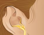 Что делать когда из уха течет жидкость, как лечить у детей и взрослых?