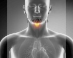 Рак голосовых связок – симптомы, лечение и прогноз для мужчин и женщин