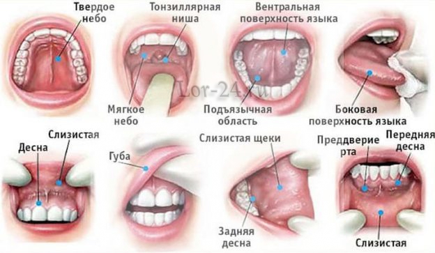 Рак дна полости рта фото